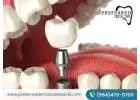Achieve a Perfect Smile with the Best Implants Denture Service