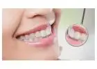 Teeth Whitening in GA