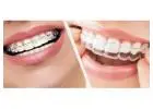 Top Smile Makeover Services in Houston, TX